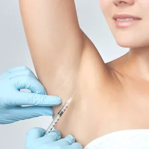 Underarm Hyperhidrosis with Toxin&nbsp;Online